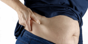 폴리글리시톨 혈당