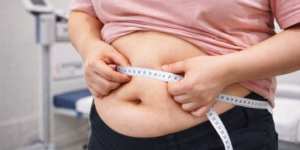 위고비 처방 BMI 검사