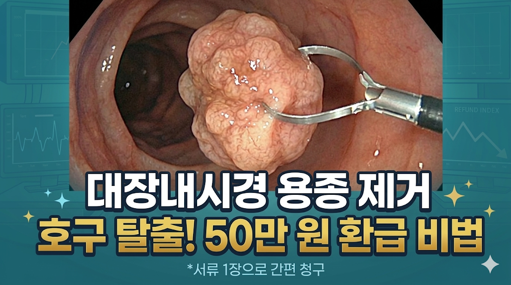 대장내시경 중 발견된 대형 용종을 의료기구로 제거하는 실제 수술 장면 사진과 실비 보험 환급 조건 및 필수 서류 정보를 안내하는 정보성 썸네일 이미지