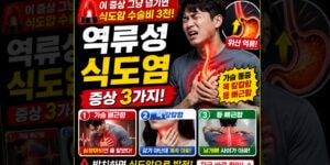 역류성 식도염 증상, 가슴 뻐근함과 조임 통증⁠