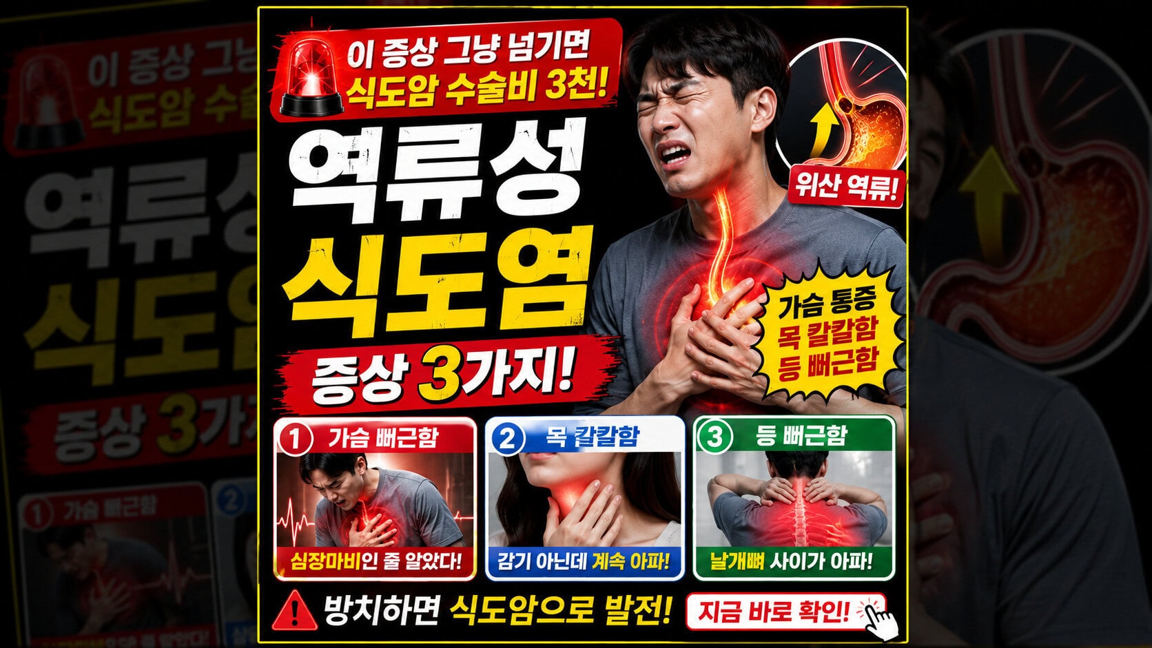 역류성 식도염 증상, 가슴 뻐근함 방치하면 수술비 3천 깨집니다