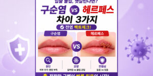 구순염 헤르페스 차이 원인 모양 전염성 비교 인포그래픽