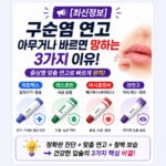 구순염 연고 오남용 부작용 경고 및 리도맥스 에스로반 올바른 사용법