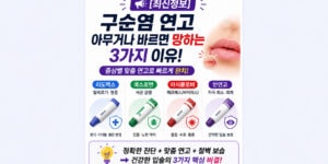 구순염 연고 오남용 부작용 경고 및 리도맥스 에스로반 올바른 사용법