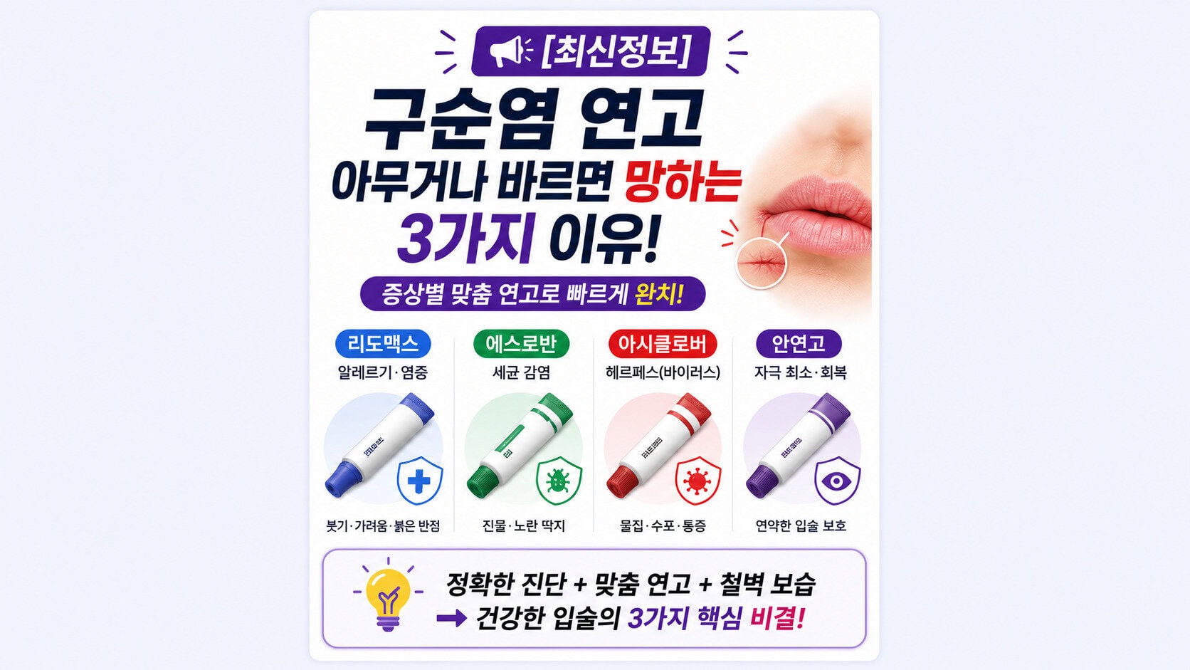 [2026 최신] 구순염 연고 아무거나 발랐다간 입술 썩습니다! 리도맥스·에스로반 증상별 완벽 가이드