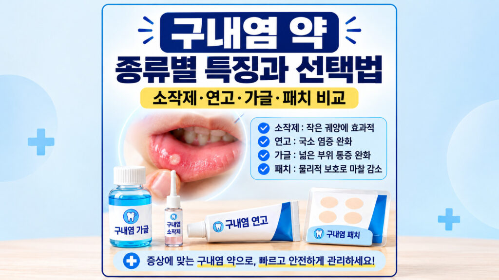 약국 구내염 약 종류인 소작제, 연고, 가글, 패치의 제형별 특징과 증상에 따른 선택법을 설명하는 인포그래픽 이미지